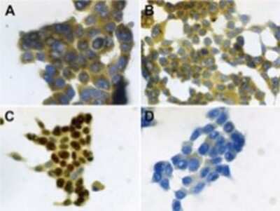 Immunocytochemistry/ Immunofluorescence: S100A7/Psoriasin Antibody (47C1068) - BSA Free [NB100-56559]
