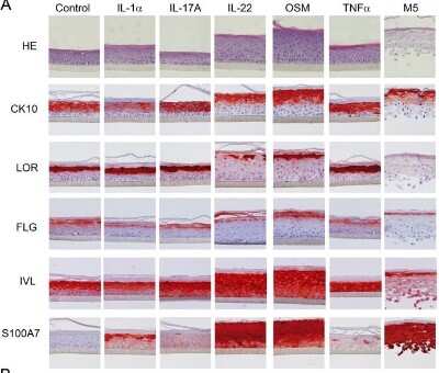 Immunohistochemistry: S100A7/Psoriasin Antibody (47C1068) - BSA Free [NB100-56559]