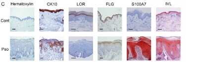 Immunohistochemistry: S100A7/Psoriasin Antibody (47C1068) - BSA Free [NB100-56559]