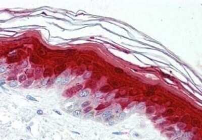 Immunohistochemistry-Paraffin: S100A7/Psoriasin Antibody (47C1068) - BSA Free [NB100-56559]