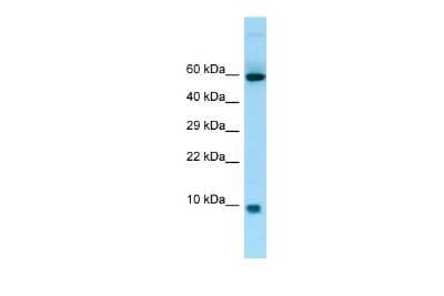 Western Blot: S100A7A Antibody [NBP3-09472]