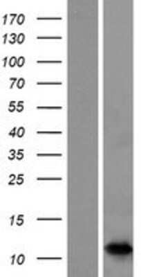 Western Blot: S100A7A Overexpression Lysate [NBP2-05018]