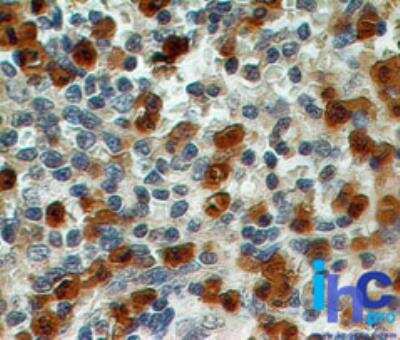 Immunohistochemistry-Paraffin: S100A8 Antibody (48M7C7) [NBP2-25256]