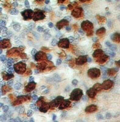 Immunohistochemistry-Paraffin: S100A8 Antibody (48M7F9) [NBP2-25257]
