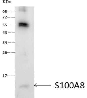 Immunoprecipitation: S100A8 Antibody (203) [NBP2-89806]