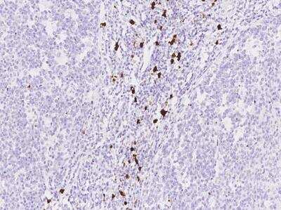 Immunohistochemistry-Paraffin: S100A8 Antibody (216) [NBP2-89808]