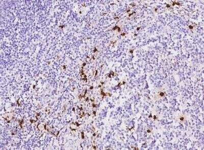 Immunohistochemistry-Paraffin: S100A8 Antibody (236) [NBP2-89809]