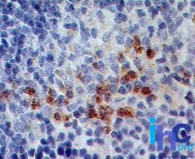 Immunohistochemistry-Paraffin: S100A8 Antibody (63N13G5) - Azide Free [NBP2-25273]