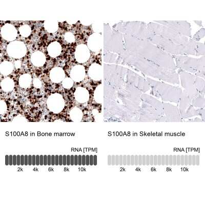 Immunohistochemistry-Paraffin: S100A8 Antibody (CL11171) [NBP3-07985]