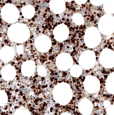Immunohistochemistry-Paraffin: S100A8 Antibody (CL11171) [NBP3-07985]