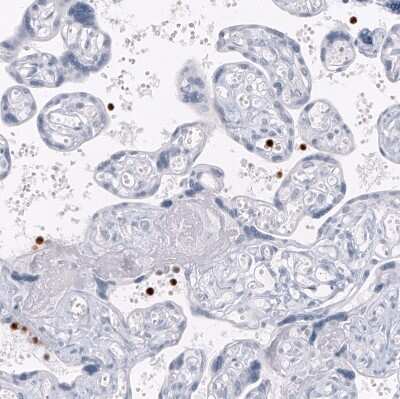 Immunohistochemistry-Paraffin: S100A8 Antibody (CL11171) [NBP3-07985]