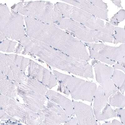 Immunohistochemistry-Paraffin: S100A8 Antibody (CL11171) [NBP3-07985]