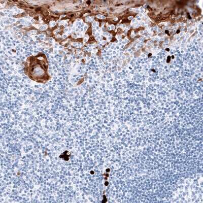 Immunohistochemistry-Paraffin: S100A8 Antibody (CL11171) [NBP3-07985]