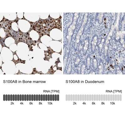 Immunohistochemistry-Paraffin: S100A8 Antibody [NBP1-90314]
