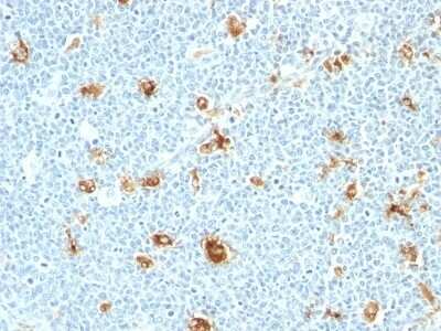 Immunohistochemistry-Paraffin: S100A9 Antibody (CAGB/426) [NBP2-44911]