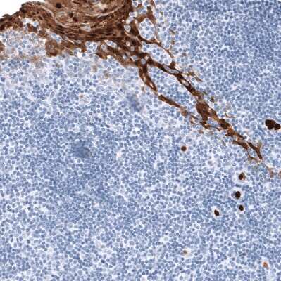 Immunohistochemistry-Paraffin: S100A9 Antibody (CL11191) [NBP3-07983]
