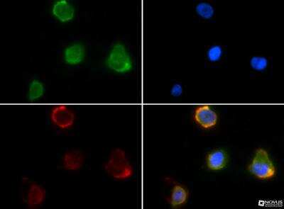 Immunocytochemistry/ Immunofluorescence: S100A9 Antibody [NB110-89726]