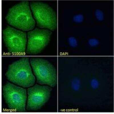 Immunocytochemistry/ Immunofluorescence: S100A9 Antibody [142Nd] [NBP1-18843]