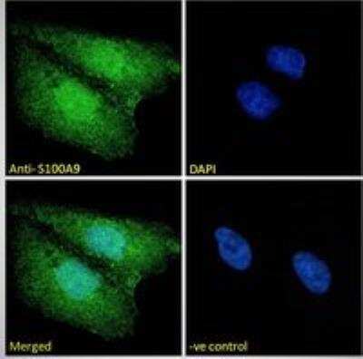 Immunocytochemistry/ Immunofluorescence: S100A9 Antibody [142Nd] [NBP1-18843]