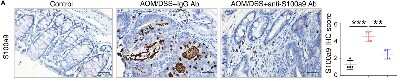 Immunohistochemistry-Paraffin: S100A9 Antibody [NB110-89726]