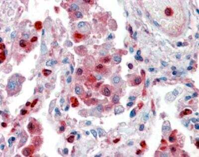Immunohistochemistry-Paraffin: S100A9 Antibody [142Nd] [NBP1-18843]