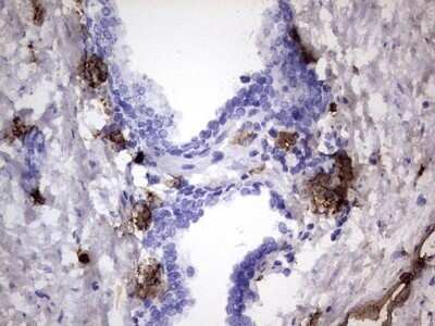 Immunohistochemistry: S100A9 Antibody (OTI10D5) - Azide and BSA Free [NBP2-73970]