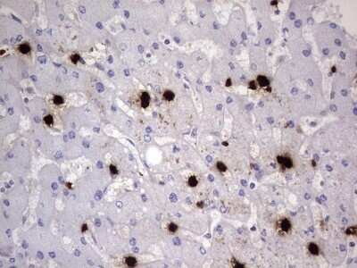 Immunohistochemistry: S100A9 Antibody (OTI10D5) - Azide and BSA Free [NBP2-73970]