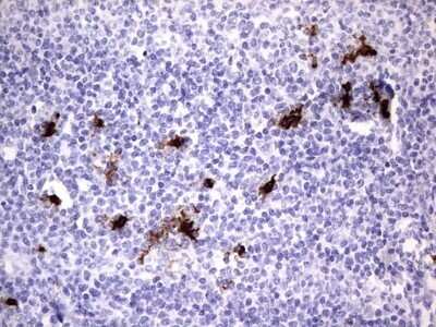 Immunohistochemistry: S100A9 Antibody (OTI10D5) - Azide and BSA Free [NBP2-73970]
