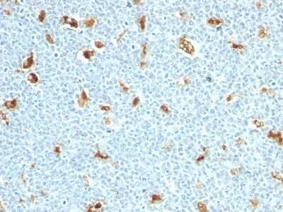 Immunohistochemistry-Paraffin: S100A9 Antibody (S100A9/1011) [NBP2-44910]