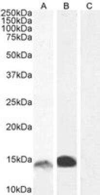 Western Blot: S100A9 Antibody [142Nd] [NBP1-18843]