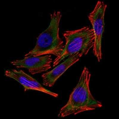 Immunocytochemistry/ Immunofluorescence: S100B Antibody (4C4.9 + S100B/1012) [NBP2-53187]