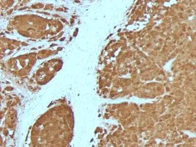 Immunohistochemistry-Paraffin: S100B Antibody (4C4.9 + S100B/1012) [NBP2-53187]