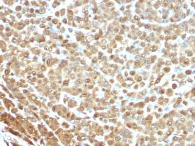 Immunohistochemistry-Paraffin: S100B Antibody (4C4.9) - Azide and BSA Free [NBP2-33168]