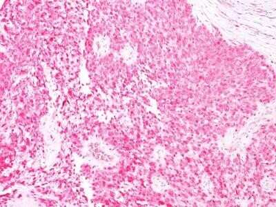 Immunohistochemistry-Paraffin: S100B Antibody (4C4.9) - IHC-Prediluted [NBP2-44590]