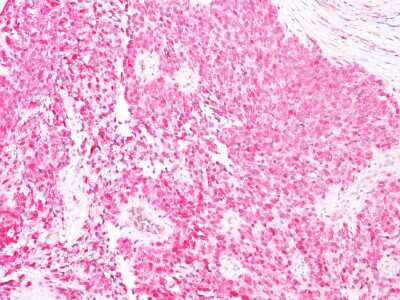 Immunohistochemistry-Paraffin: S100B Antibody (4C4.9) [NBP2-29403]