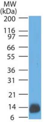 Western Blot: S100B Antibody (4C4.9) [NBP2-29403]