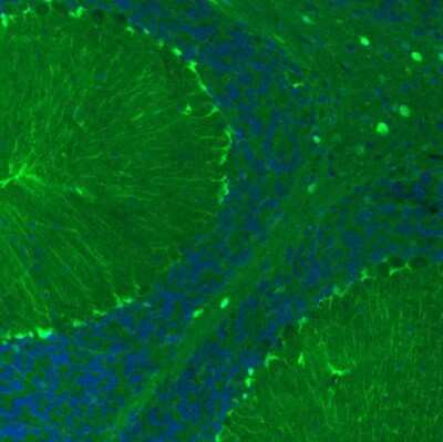 Immunohistochemistry: S100B Antibody (CL2720) [NBP2-46626]
