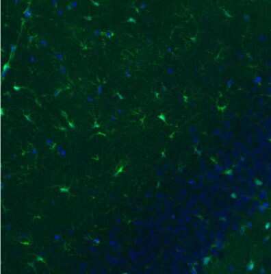 Immunohistochemistry: S100B Antibody (CL2720) [NBP2-46626]