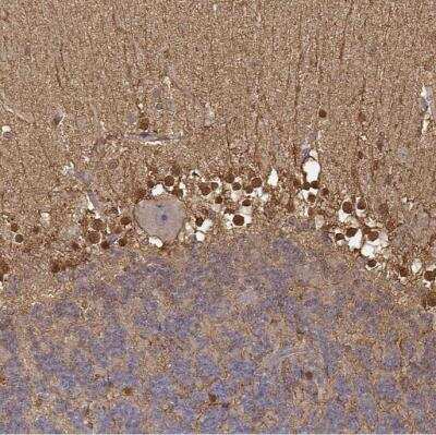 Immunohistochemistry-Paraffin: S100B Antibody [NBP1-87102]