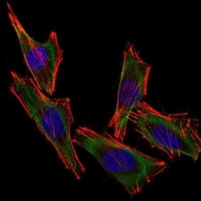 Immunocytochemistry/ Immunofluorescence: S100B Antibody (S100B/1012) - Azide and BSA Free [NBP2-59619]
