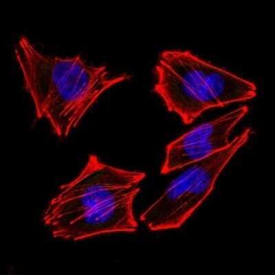 Immunocytochemistry/ Immunofluorescence: S100B Antibody (S100B/1012) - Azide and BSA Free [NBP2-59619]