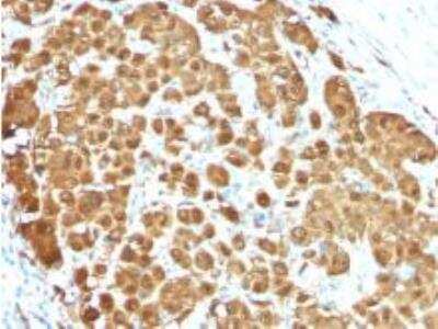 Immunohistochemistry-Paraffin: S100B Antibody (S100B/1012) [NBP2-59618]