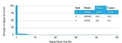 Protein Array: S100B Antibody (S100B/1012) [NBP2-59618]
