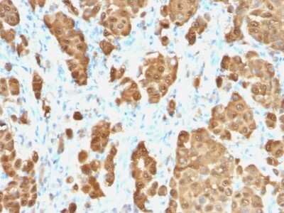 Immunohistochemistry-Paraffin: S100B Antibody (S100B/1706R) [NBP2-53188]