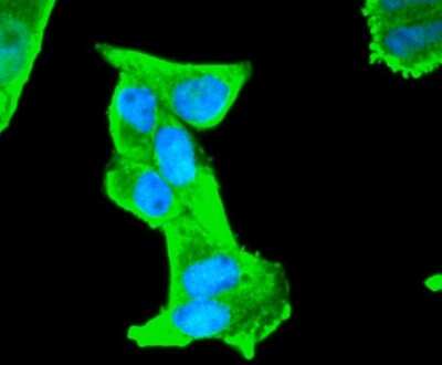 Immunocytochemistry/ Immunofluorescence: S100B Antibody (SC57-02) [NBP2-67572]
