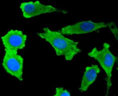 Immunocytochemistry/ Immunofluorescence: S100B Antibody (SC57-02) [NBP2-67572]