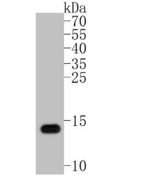 Western Blot: S100B Antibody (SC57-02) [NBP2-67572]