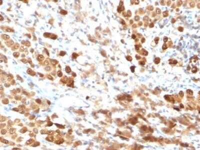 Immunohistochemistry-Paraffin: S100B Antibody (SPM354) [NBP2-53271]