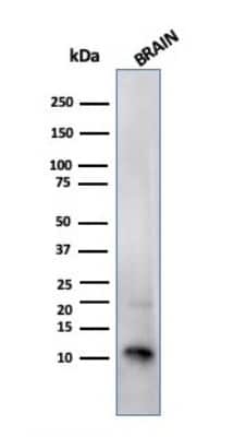 Western Blot: S100B Antibody (SPM354) [NBP2-53271]