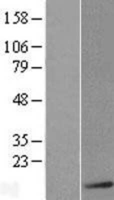 Western Blot: S100B Overexpression Lysate [NBL1-15661]